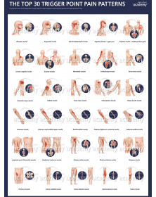 Poster TOP30 des points trigger de la DG Simons Academy (DGSA)