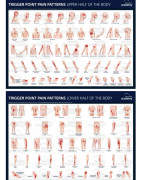 Posters de point trigger